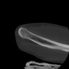 SPORK, NICO - 22.03.1976 - 02.08.2022 - CT obere Extremität - 17:59:38